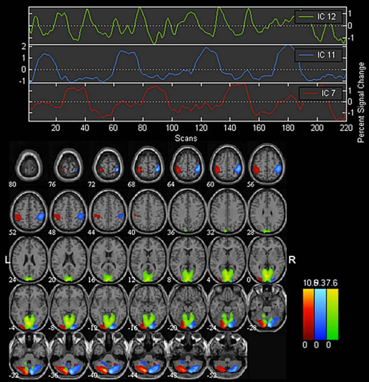 Composite viewer display method...